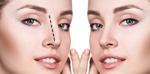 جراحی ترمیمی بینی