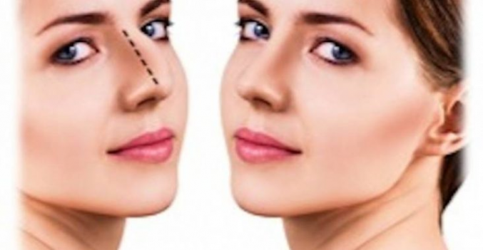 بهترین دکتر متخصص رینوپلاستی در تهران