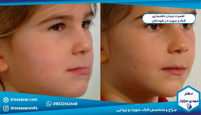 درمان ناهنجاری فک و صورت در کودکان
