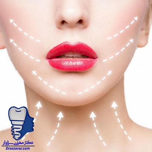 مزایای جراحی ساکشن غبغب