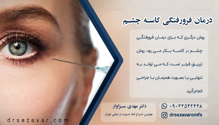 درمان فرورفتگی کاسه چشم