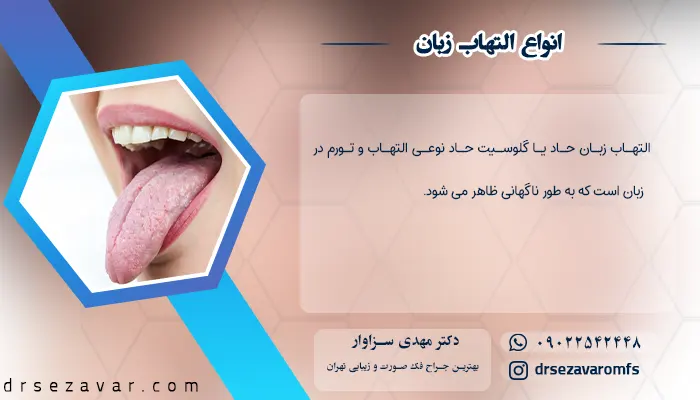 انواع التهاب زبان