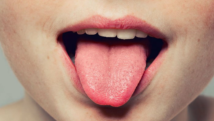 علت تورم و التهاب زبان چیست؟