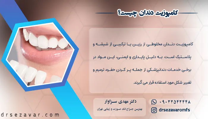 کامپوزیت دندان چیست؟