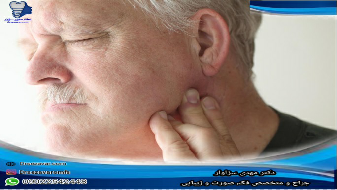 اسپاسم فک چیست