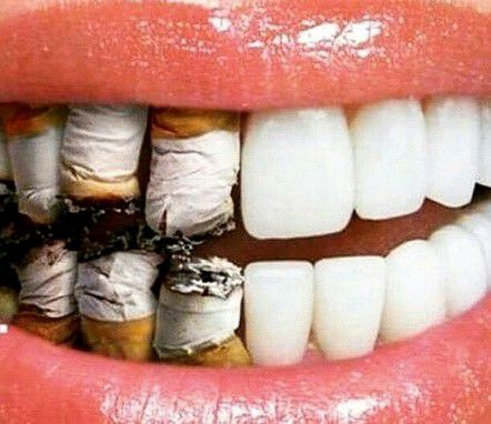 علت تاثیر سیگار بر ایمپلنت‌های دندانی چیست؟