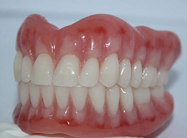 مقایسه دندان مصنوعی و ایمپلنت