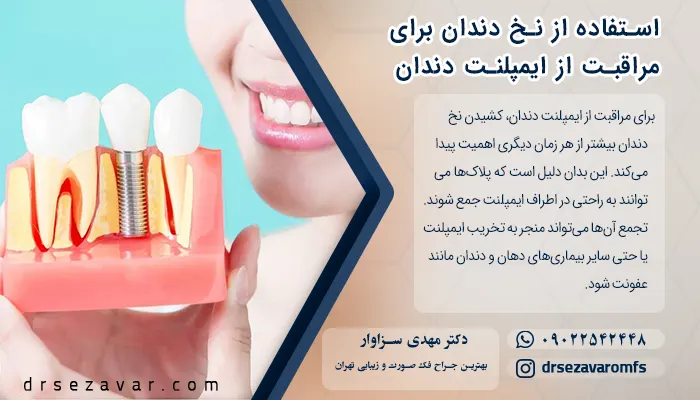 استفاده از نخ دندان برای مراقبت از ایمپلنت دندان
