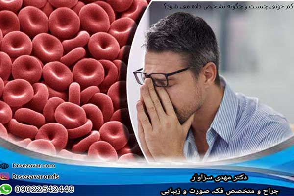 کم خونی چیست و چگونه تشخیص داده می شود