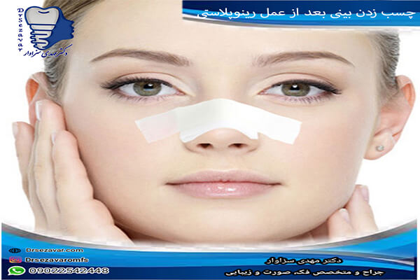 چسب زدن بینی بعد از عمل رینوپلاستی