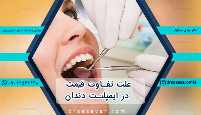 ایمپلنت دندان ارزان