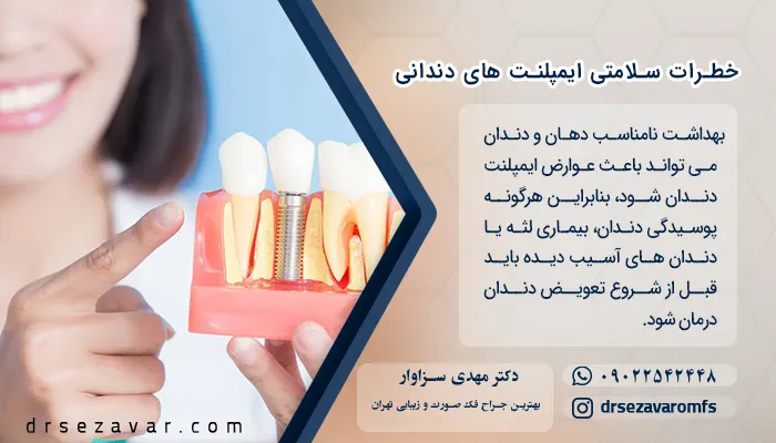 خطرات سلامتی ایمپلنت های دندانی