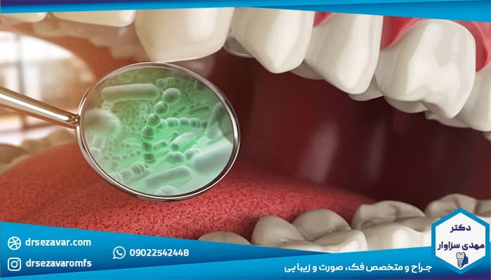رایج ترین عوارض ایمپلنت دندان