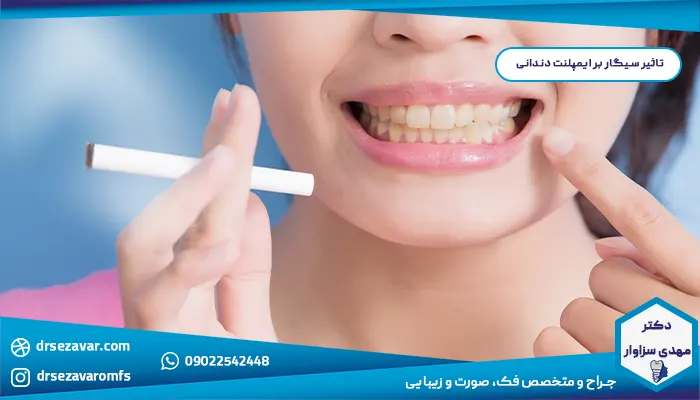 تاثیر سیگار بر ایمپلنت دندانی