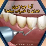 آیا جرمگیری دندان را خراب می کند؟