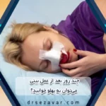 نحوه خوابیدن بعد از عمل بینی ، تا چند روز بعد عمل بینی میتوان به پهلو خوابید