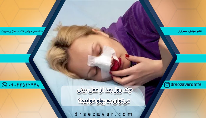 نحوه خوابیدن بعد از عمل بینی ، تا چند روز بعد عمل بینی میتوان به پهلو خوابید
