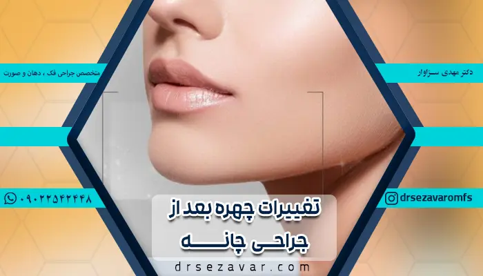 تغییرات چهره پس از انجام جراحی چانه و فک