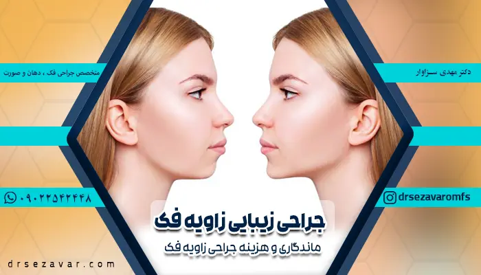 وضعیت فک زیباجو قبل و بعد از جراحی زیبایی زاویه فک