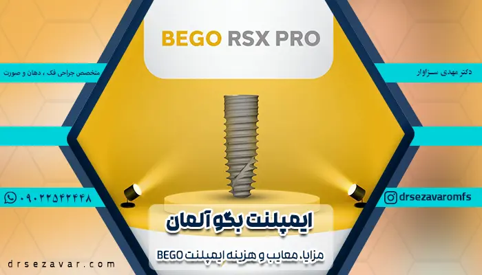 ایمپلنت Bego آلمانی