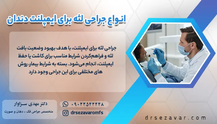 دندانپزشک در حال پیوند لثه برای ایمپلنت است.
