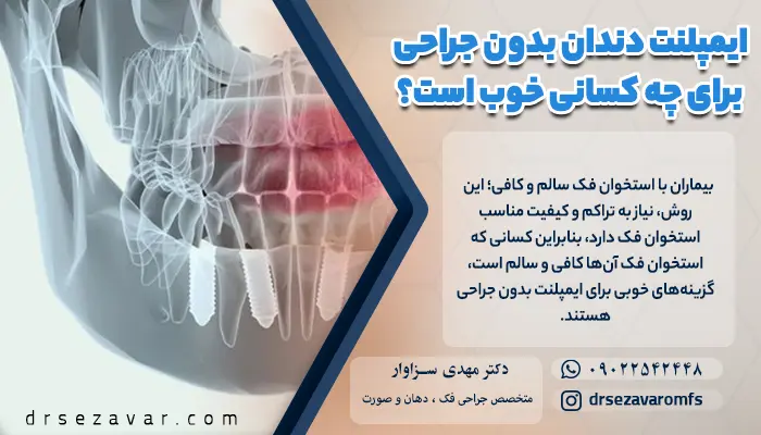 بیماران با استخوان فک سالم و کافی کاندید مناسبی برای انجام ایمپلنت دندان بدون جراحی هستند.