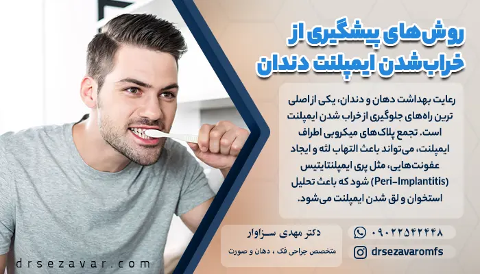 یکی از روش های پیشگیری از خراب شدن ایمپلنت دندان، استفاده از مسواک و دهان شویه ست.
