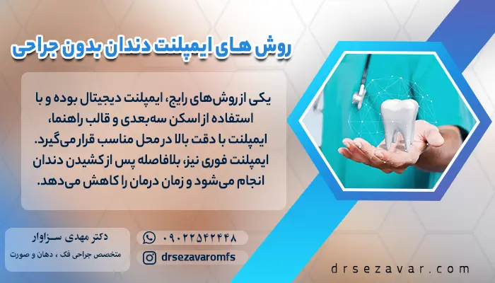 روش های ایمپلنت دندان بدون جراحی