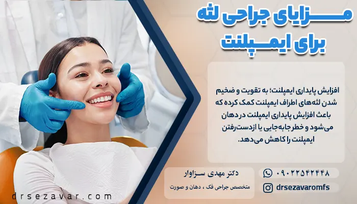 افزایش پایداری ایمپلنت یکی از مزایای کاشت لثه در ایمپلنت دندان است.