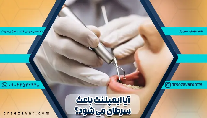 ارتباط بین ایمپلنت و سرطان