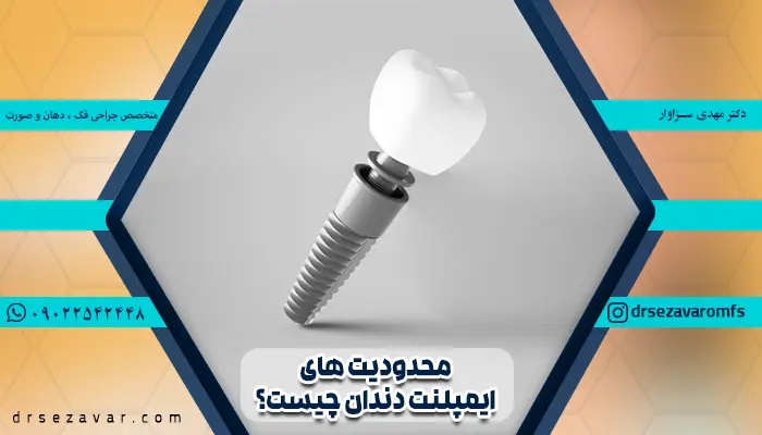 محدودیت های ایمپلنت دندان