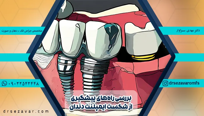 ایمپلنت شکسته شده