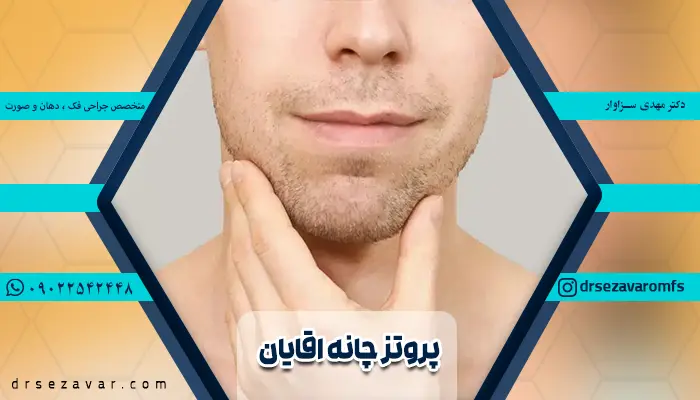 مردی که پس از انجام جراجی پروتز چانه به یک چهره خوش فرم رسیده است.