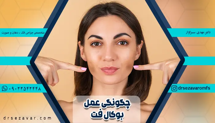 زنی که مراحل انجام عمل بوکال فت را طی کرده و به ظاهری زیبا رسیده.