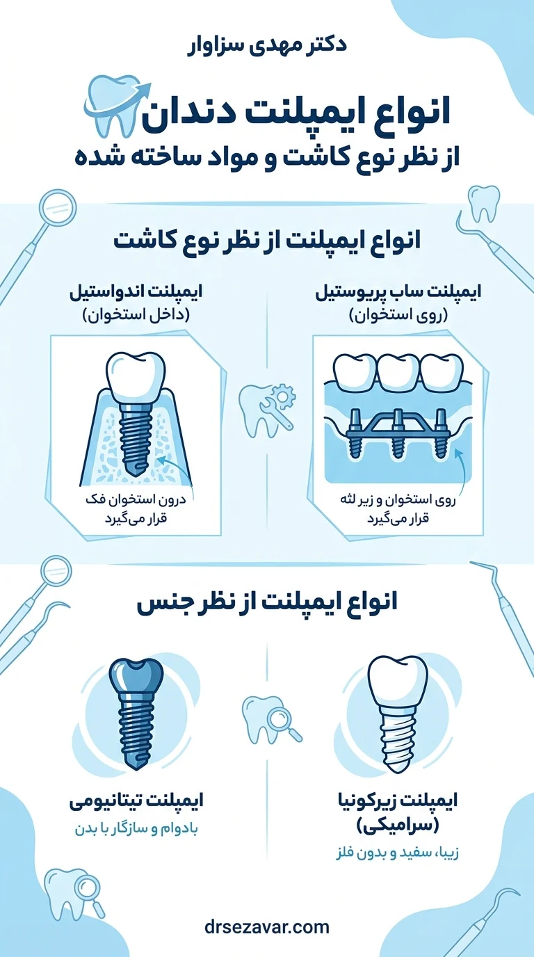 انواع ایمپلنت دندان از نظر نوع کاشت و جنس