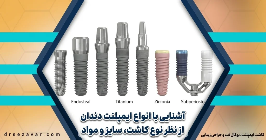 انواع ایمپلنت دندان از نظر نوع کاشت و قرارگیری در فک و لثه