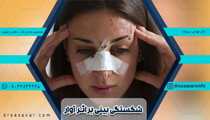 شخصی که به دلیل ریختن آوار دچار شکستگی بینی شده و جراحی کرده است.