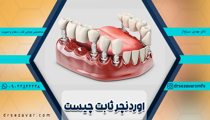تصویری از تاج، ابانتمنت و پایه های اوردنچر ثابت