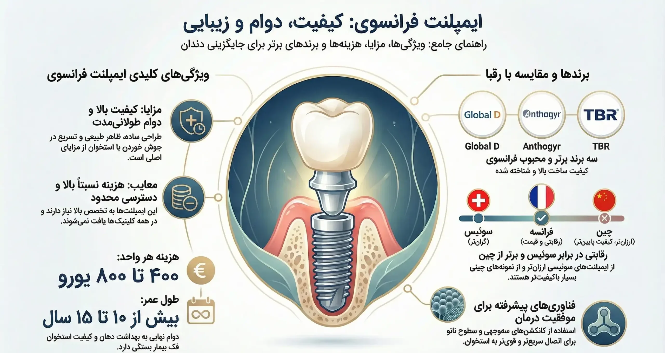 ایمپلنت فرانسوی - تصویر اینفوگرافیک