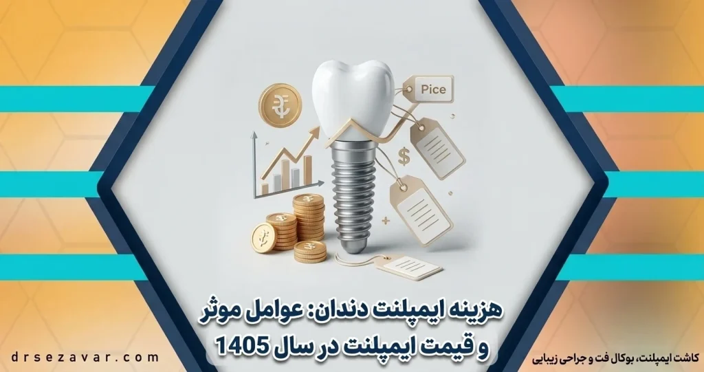 هزینه ایمپلنت دندان