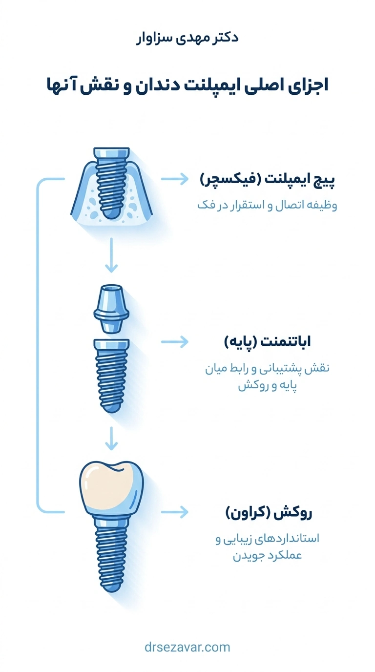 اجزای اصلی ایمپلنت دندان