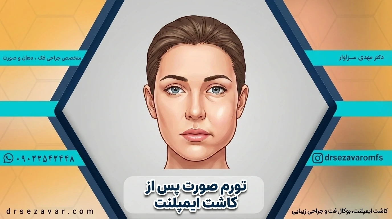 شخصی که به ورم صورت بعد از ایمپلنت دچار شده است.