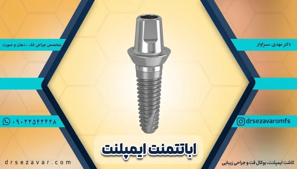 اباتمنت ایمپلنت