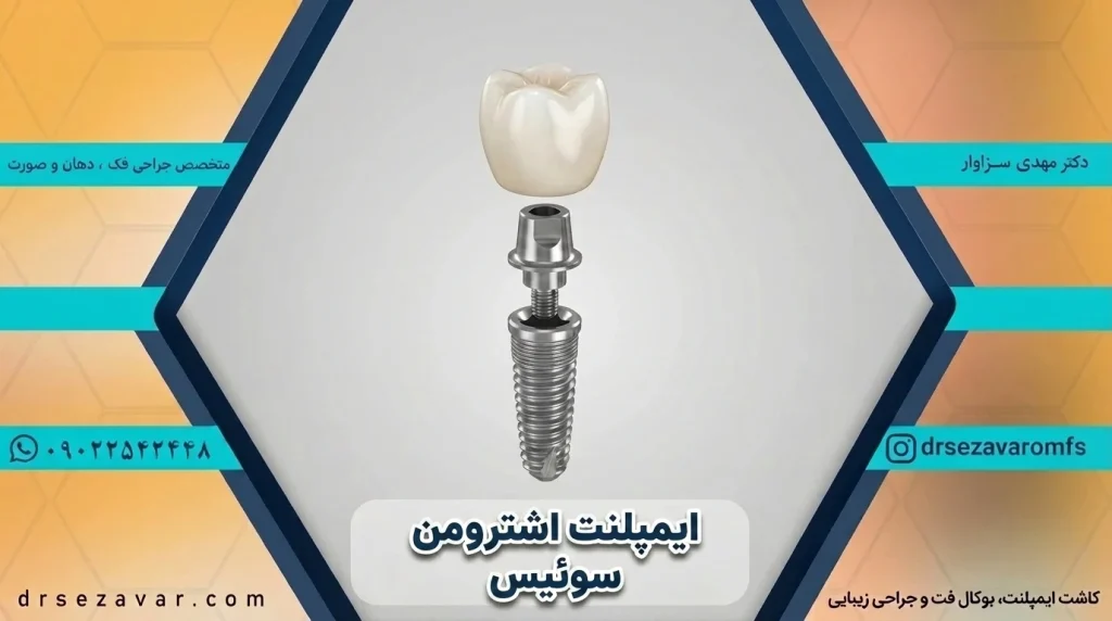 ایمپلنت سوئیسی اشترومن
