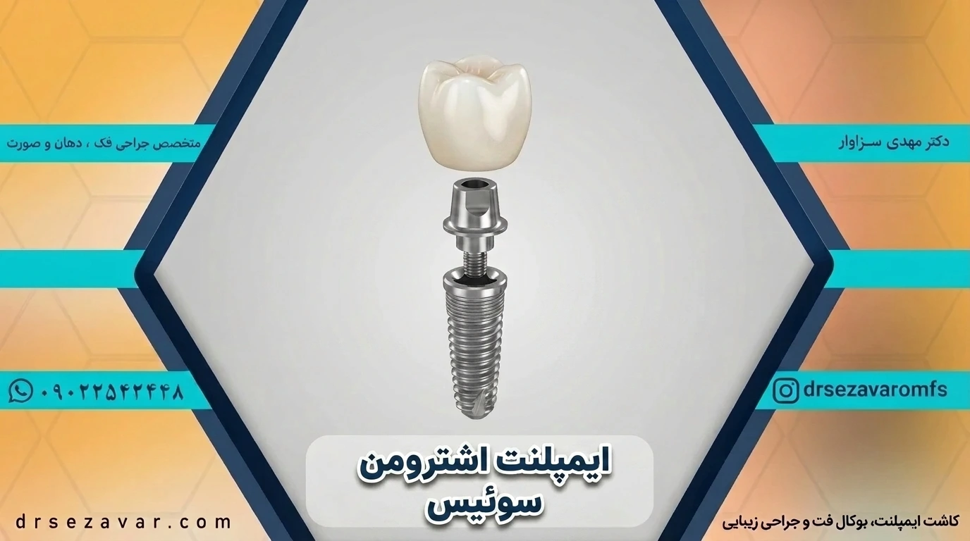 ایمپلنت سوئیسی اشترومن