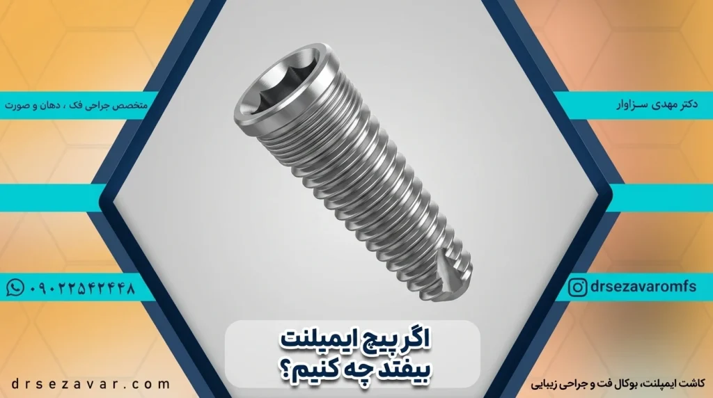 افتادن پیچ ایمپلنت دندان