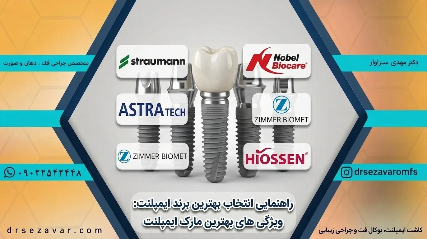 لوگوهای بهترین برند ایمپلنت