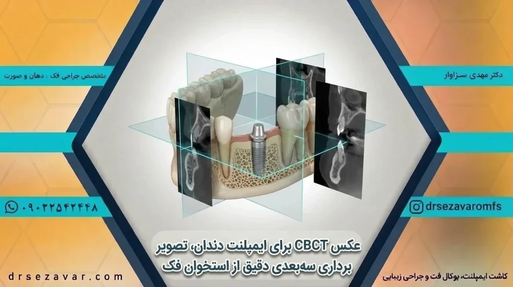 عکس CBCT برای ایمپلنت دندان