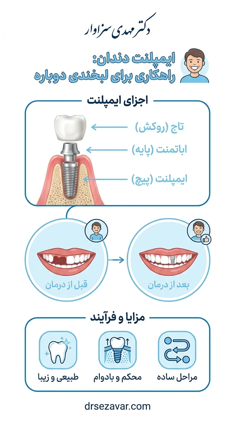 معرفی اجزا، مزایا و مراحل ایمپلنت دندان