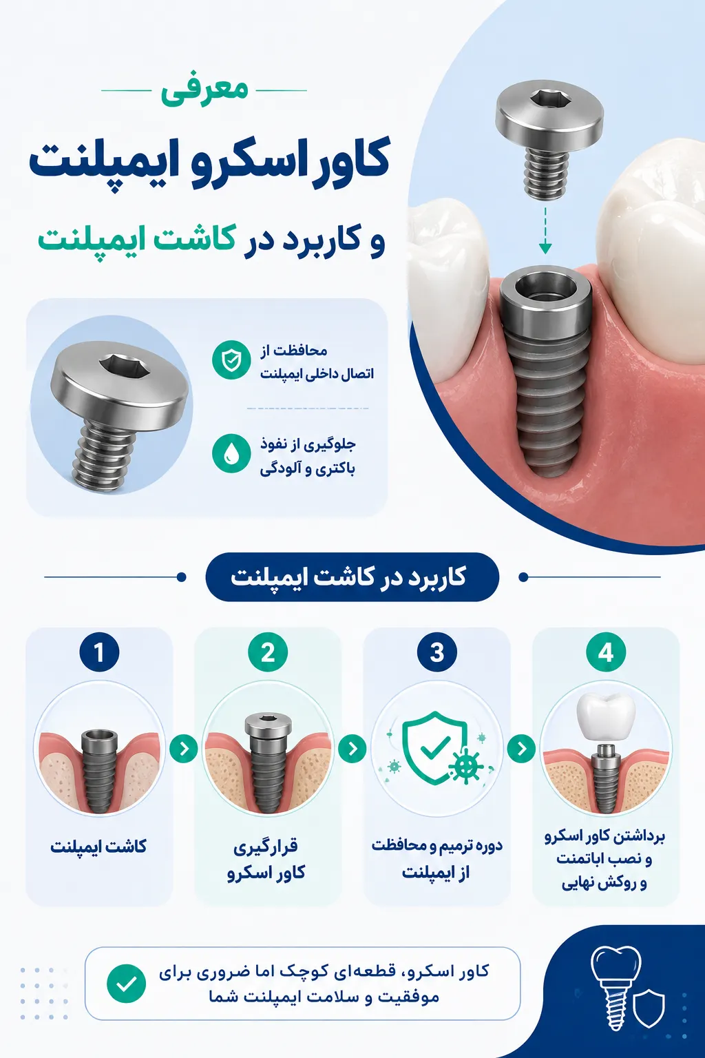 کاور اسکرو ایمپلنت دندان و نقش آن در روند کاشت ایمپلنت